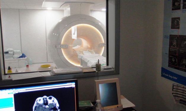 El Plan de Renovación de Alta Tecnología Sanitaria permite realizar un 60% más de resonancias magnéticas en el Hospital de Ciudad Real